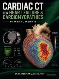 Cardiac CT for Heart Failure &amp; Cardiomyopathies: Practical Insights