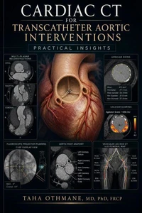 Cardiac CT for Transcatheter Aortic Interventions: Practical Insights