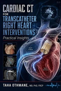 Cardiac CT for Transcatheter Right Heart Interventions: Practical Insights