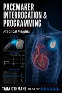 Pacemaker Interrogation &amp; Programming: Practical Insights