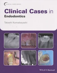 Clinical Cases in Endodontics