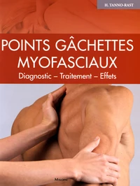 Points gâchettes myofasciaux