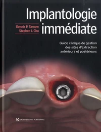 Implantologie immédiate