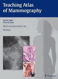 Teaching Atlas of Mammography.