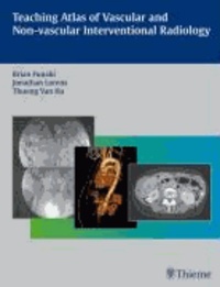 Teaching Atlas of Vascular and Non-vascular Interventional Radiology.
