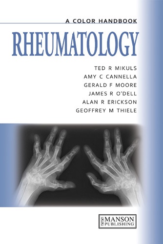 Ted R Mikuls - Rheumatology - A Color Handbook.
