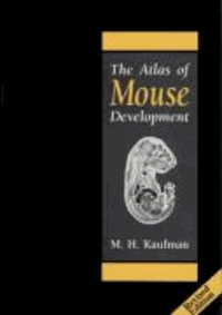 The Atlas of Mouse Development.