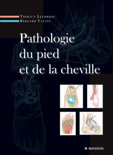 Pathologie Du Pied Et De La Cheville - 