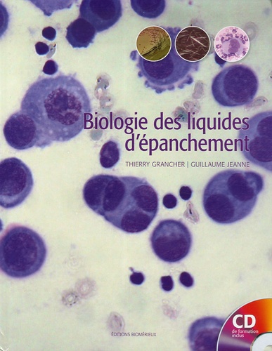 Thierry Grancher et Guillaume Jeanne - Biologie des liquides dépanchement. 1 Cédérom