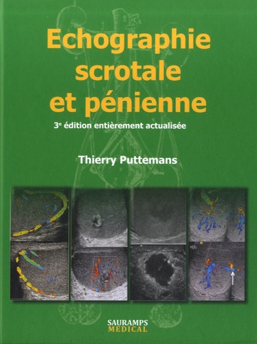 Thierry Puttemans - Echographie scrotale et pénienne.
