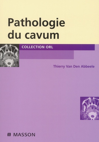 Thierry Van Den Abbeele - Pathologie Du Cavum.