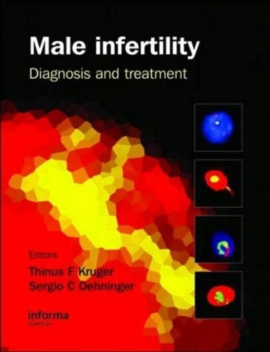 Thinus F. Kruger - Male Infertility.