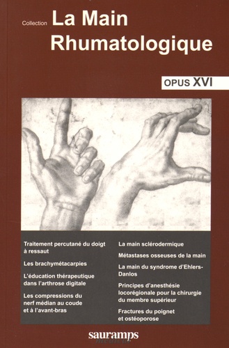Thomas Bardin - La main rhumatologique - Tome 16.
