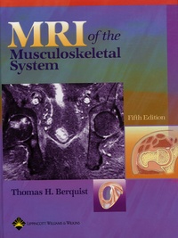 Thomas-H Berquist - MRI of the Musculoskeletal System.