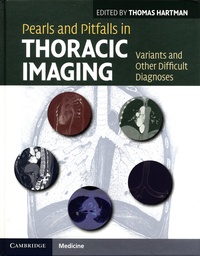 Thomas Hartman - Pearls and Pitfalls in Thoracic Imaging - Variants and Other Difficult Diagnoses.