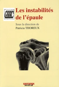 Les instabilités de l'épaule