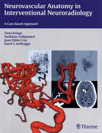 Neurovascular Anatomy in Interventional Neuroradiology