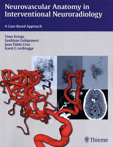 Timo Krings et Sasikhan Geibprasert - Neurovascular Anatomy in Interventional Neuroradiology - A Case-Based Approach.