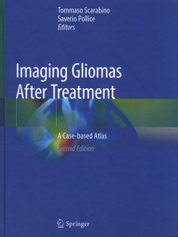 Tommaso Scarabino et Saverio Pollice - Imaging Gliomas After Treatment - A Case-based Atlas.