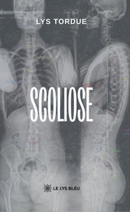 Scoliose