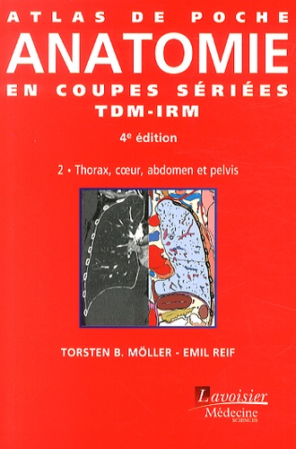 TorstenB. Möller et Emil Reif - Atlas de poche d'anatomie en coupes sériées TDM-IRM - Volume 2, Thorax, coeur, abdomen et pelvis.