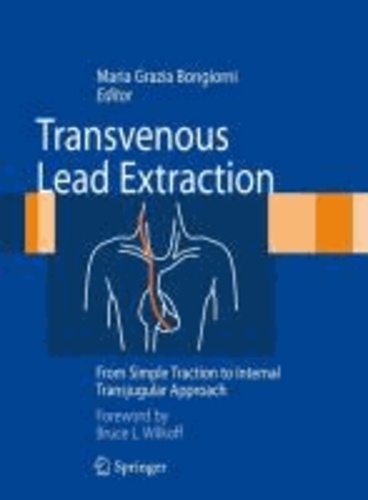 Maria Grazia Bongiorni - Transvenous Lead Extraction - From Simple Traction to Internal Transjugular Approach.