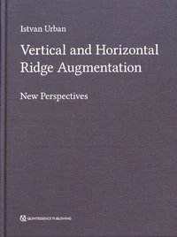 Vertical and Horizontal Ridge Augmentation