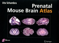 Goodtastepolice.fr Prenatal Mouse Brain Atlas - Color images and annotated diagrams of : Gestational Days 12, 14, 16 and 18 Sagittal, coronal and horizontal section Image
