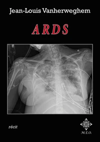 ARDS