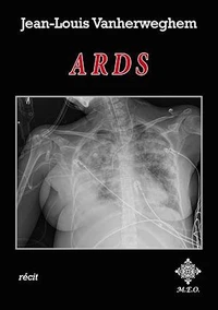 ARDS