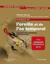Imagerie de l'oreille et de l'os temporal