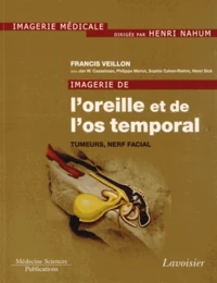 Imagerie de l'oreille et de l'os temporal