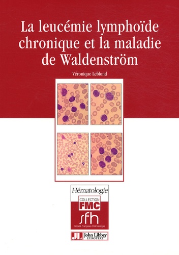 Véronique Leblond - La leucémie lymphoïde chronique et la maladie de Waldenström.