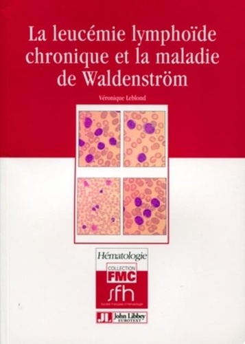 Véronique Leblond - La leucémie lymphoïde chronique et la maladie de Waldenström.