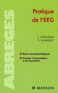 Pratique de l'EEG