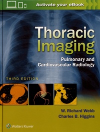 Rhonealpesinfo.fr Thoracic Imaging - Pulmonary and Cardiovascular Radiology Image