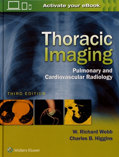 Thoracic Imaging. Pulmonary and Cardiovascular Radiology 3rd edition