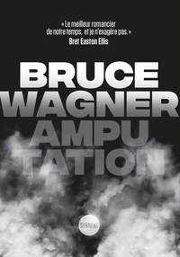 Amputation