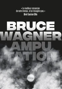 Amputation