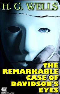 The Remarkable Case of Davidson's Eyes. Illustrated