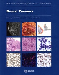 Livres format pdf téléchargement gratuit Breast Tumours PDF RTF CHM 9789283245001 par WHO Classification of Tumours