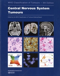  WHO Classification of Tumours - Central Nervous System Tumours - WHO Classification of Tumours.