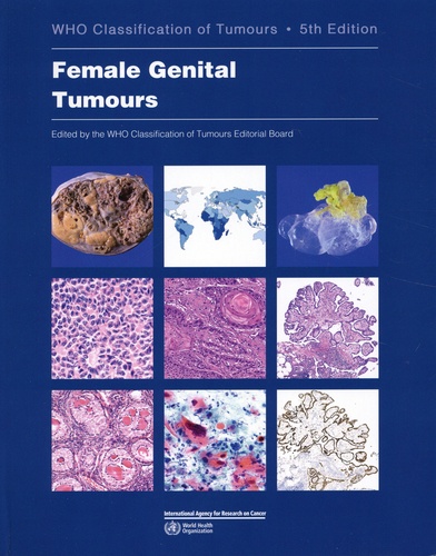 Female Genital Tumours 5th edition