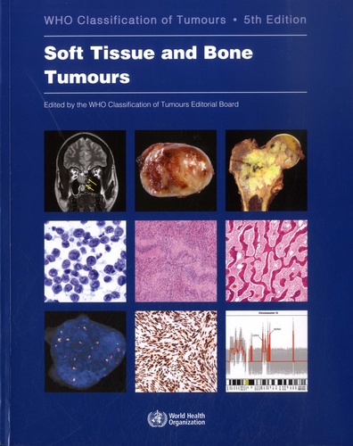 Soft Tissue and Bone Tumours 5th edition