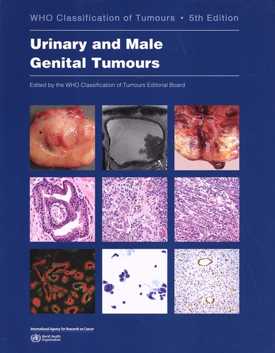 Urinary and Male Genital Tumours 5th edition