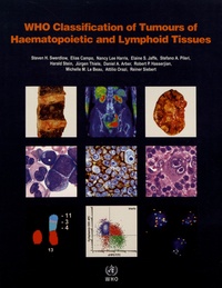  WHO - WHO Classification of Tumours of Haematopoietic and Lymphoid Tissues.