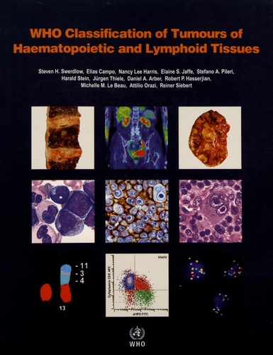 WHO Classification of Tumours of Haematopoietic and Lymphoid Tissues 4th edition