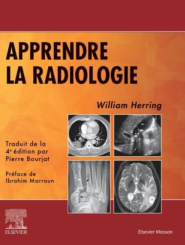 Apprendre la radiologie 4e édition