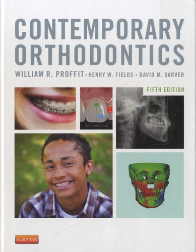 William R. Proffit et Henry W. Fields - Contemporary Orthodontics.