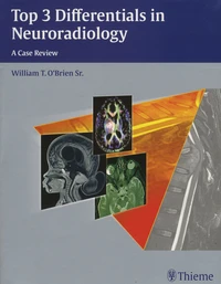 Top 3 Differentials in Neuroradiology